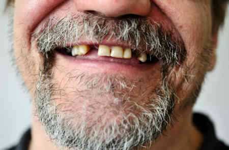 Los dientes son fusibles del cuerpo multidimensional