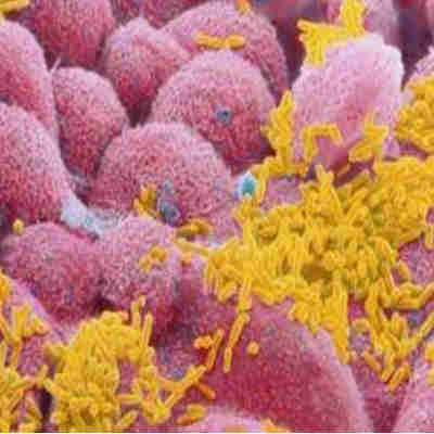 Virus espirituales, parásitos psíquicos, imagen de virus tomada por microscopio electrónico.