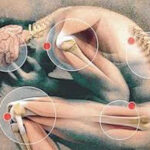 fibromialgia2-500
